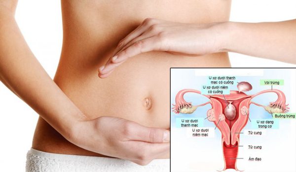 Triệu chứng đau bụng dưới ở nam và nữ giới là bệnh gì?